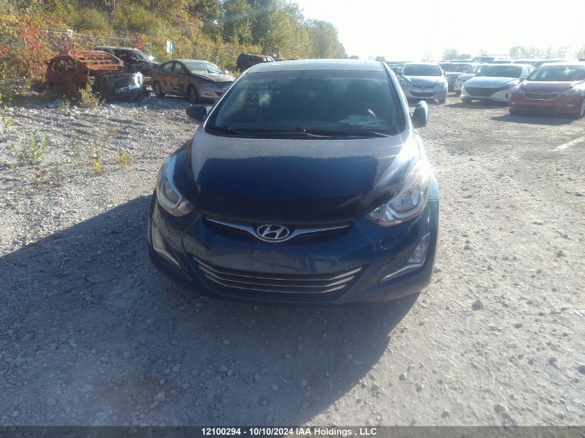 KMHDH4AH0FU418576 2015 Hyundai Elantra