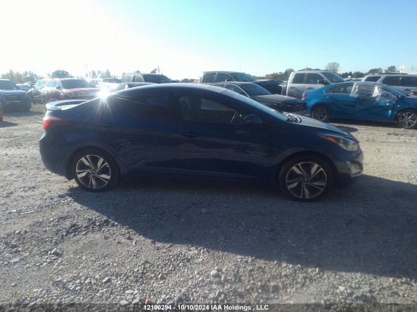 KMHDH4AH0FU418576 2015 Hyundai Elantra