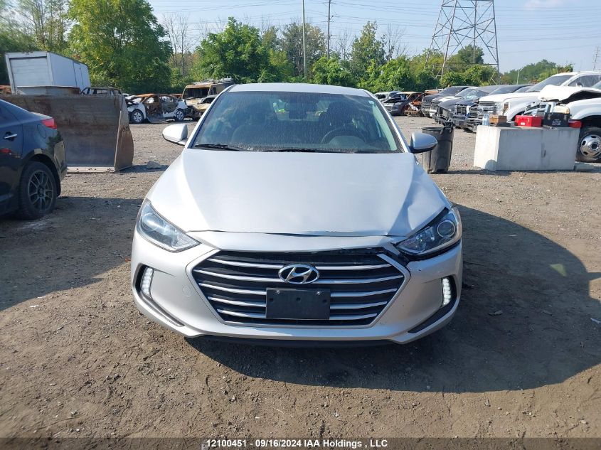 KMHD84LFXHU374312 2017 Hyundai Elantra Se/Value/Limited