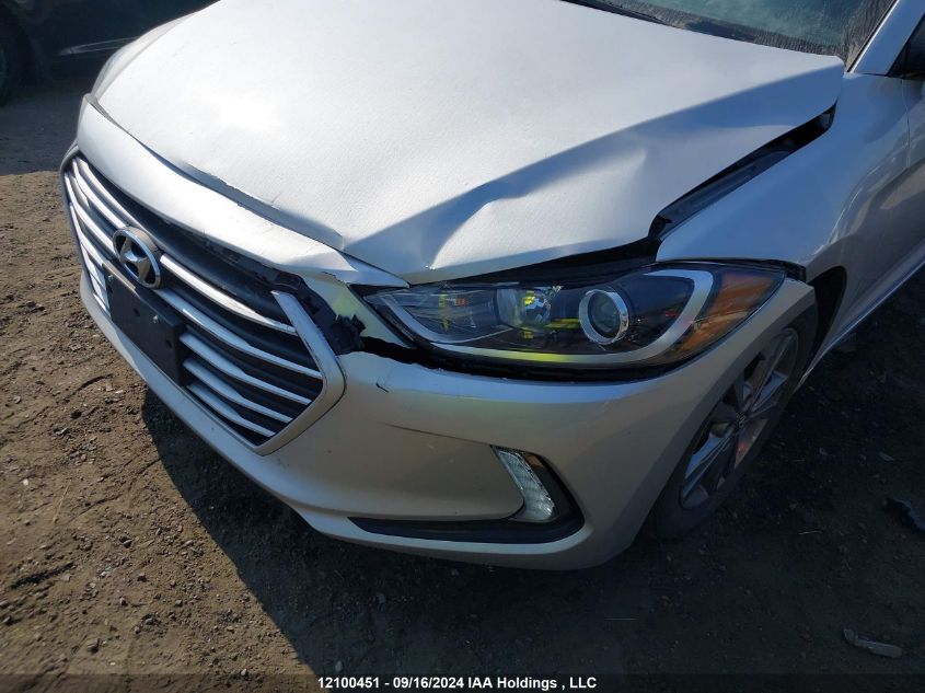 KMHD84LFXHU374312 2017 Hyundai Elantra Se/Value/Limited