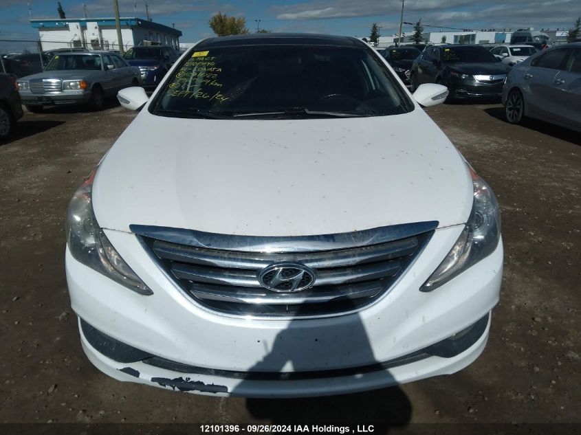 5NPEC4AC2EH871022 2014 Hyundai Sonata Se/Limited