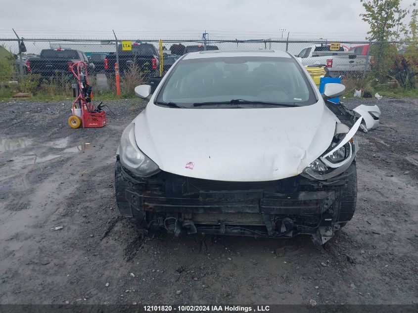 KMHDH4AH6FU452294 2015 Hyundai Elantra