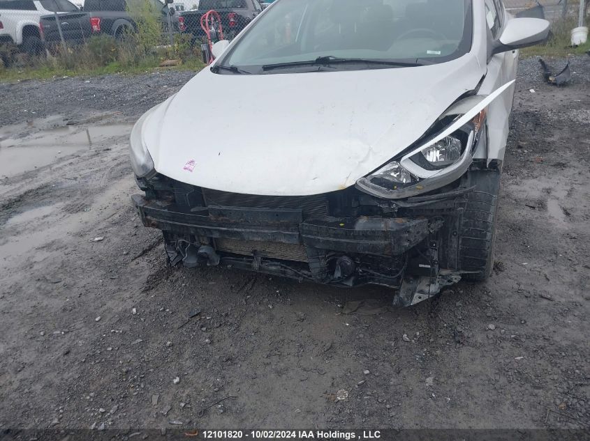 KMHDH4AH6FU452294 2015 Hyundai Elantra