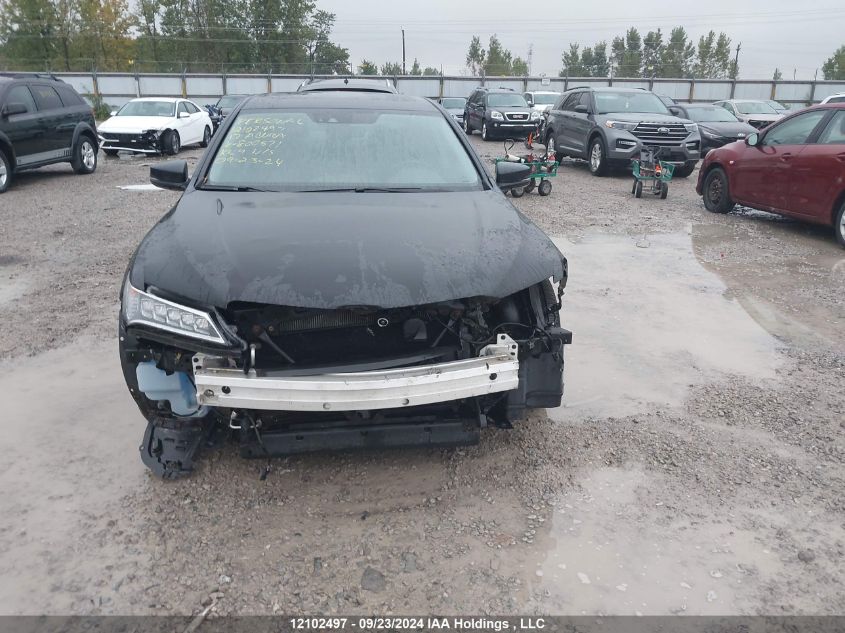 19UUB1F54HA800571 2017 Acura Tlx