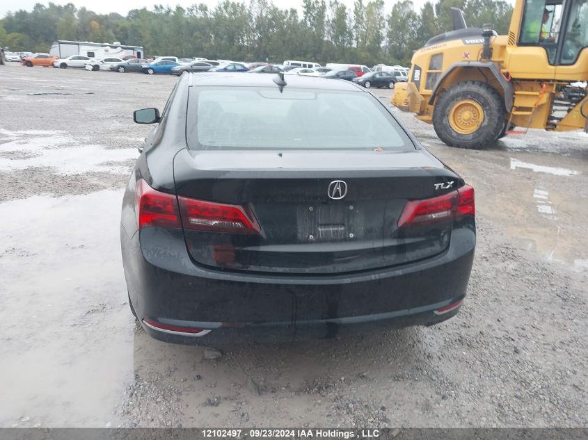 19UUB1F54HA800571 2017 Acura Tlx