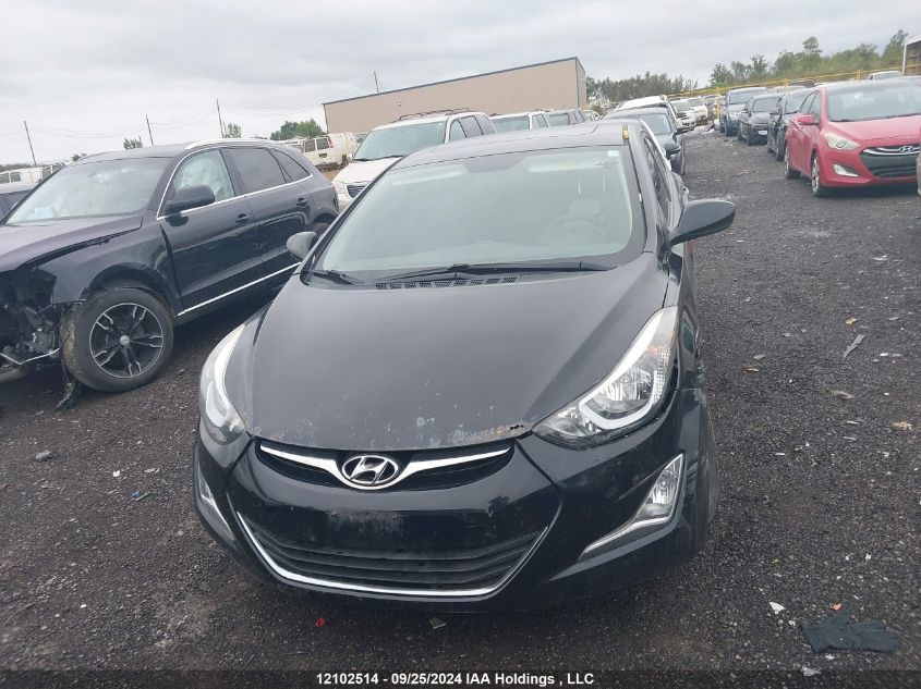 2016 Hyundai Elantra Sport Appearance VIN: KMHDH4AE0GU569117 Lot: 12102514