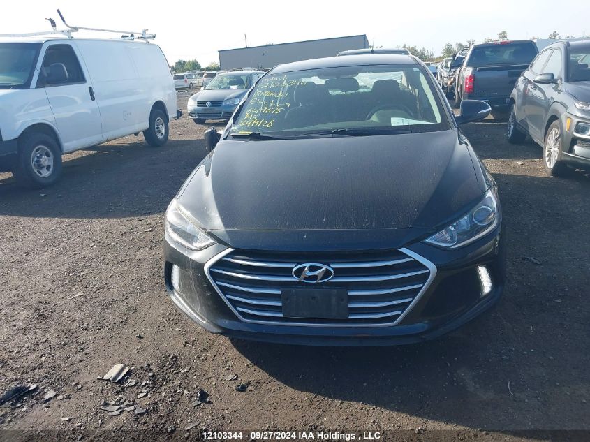 KMHD84LF0JU649675 2018 Hyundai Elantra