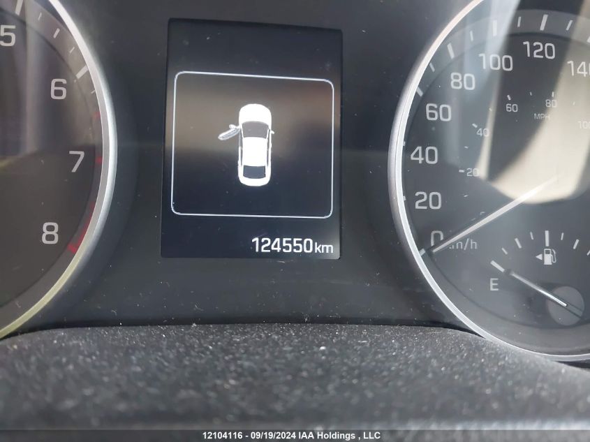 KMHD84LF4JU538868 2018 Hyundai Elantra Gl Se