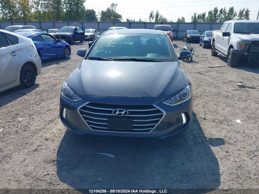 KMHD84LF1HU404586 2017 Hyundai Elantra Se/Value/Limited