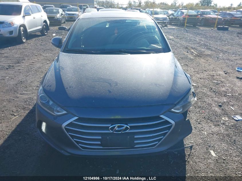 2017 Hyundai Elantra Se/Value/Limited VIN: KMHD84LF3HU097695 Lot: 12104986