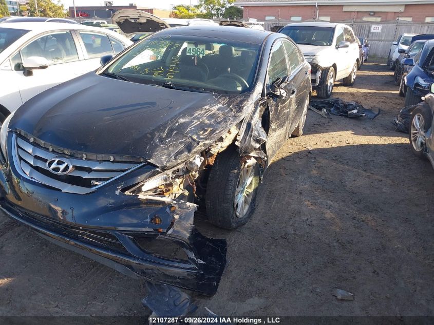 2013 Hyundai Sonata Se VIN: 5NPEC4AC8DH591314 Lot: 12107287