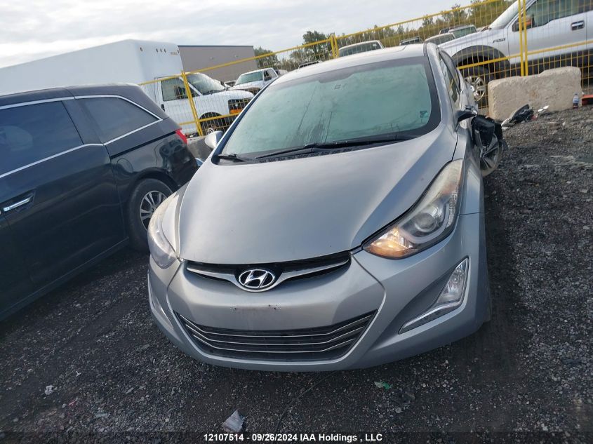 KMHDH4AH1FU368237 2015 Hyundai Elantra Se/Sport/Limited