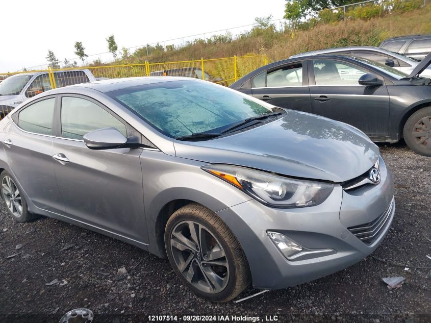 KMHDH4AH1FU368237 2015 Hyundai Elantra Se/Sport/Limited