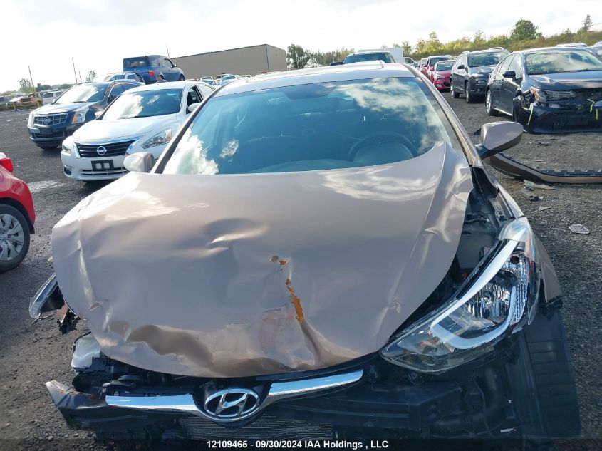 KMHDH4AE2GU570902 2016 Hyundai Elantra Sport Appearance