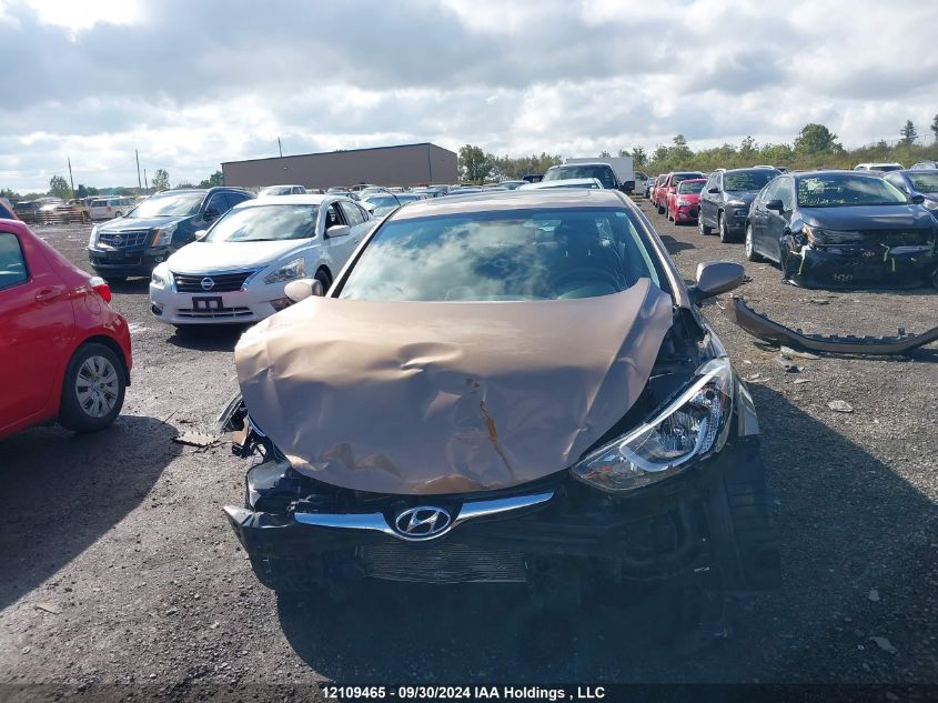 KMHDH4AE2GU570902 2016 Hyundai Elantra Sport Appearance