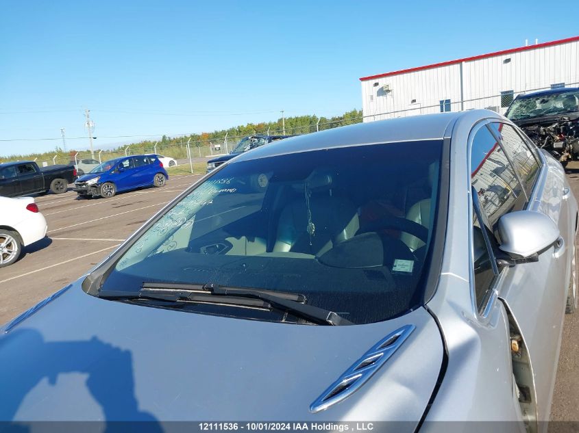 1G4P15SK3G4104147 2016 Buick Verano