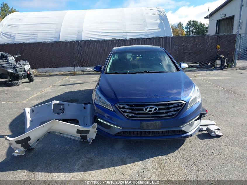 2017 Hyundai Sonata Sport/Limited VIN: 5NPE34AF7HH587951 Lot: 12113005