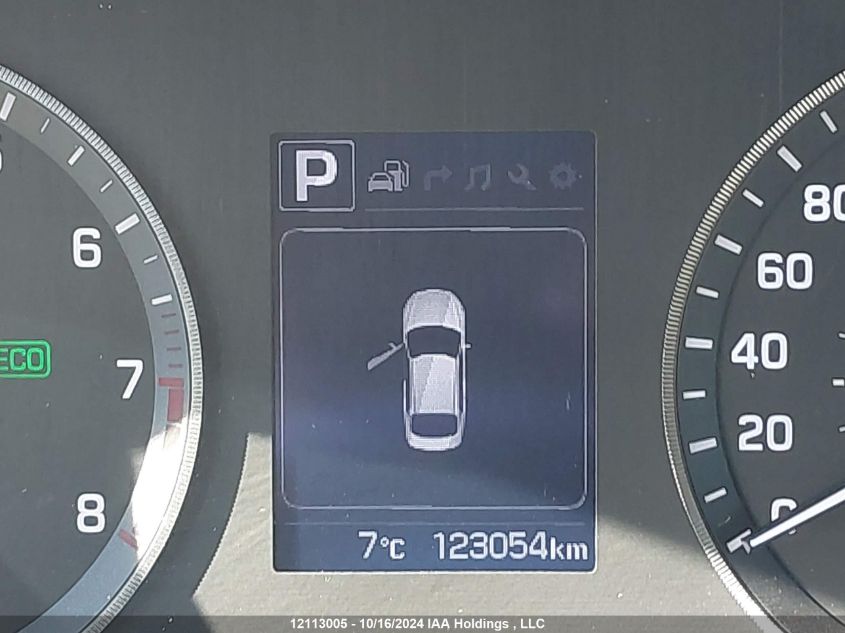 2017 Hyundai Sonata Sport/Limited VIN: 5NPE34AF7HH587951 Lot: 12113005