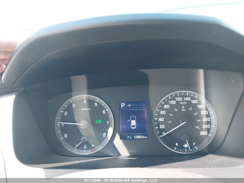 2017 Hyundai Sonata Sport/Limited VIN: 5NPE34AF7HH587951 Lot: 12113005