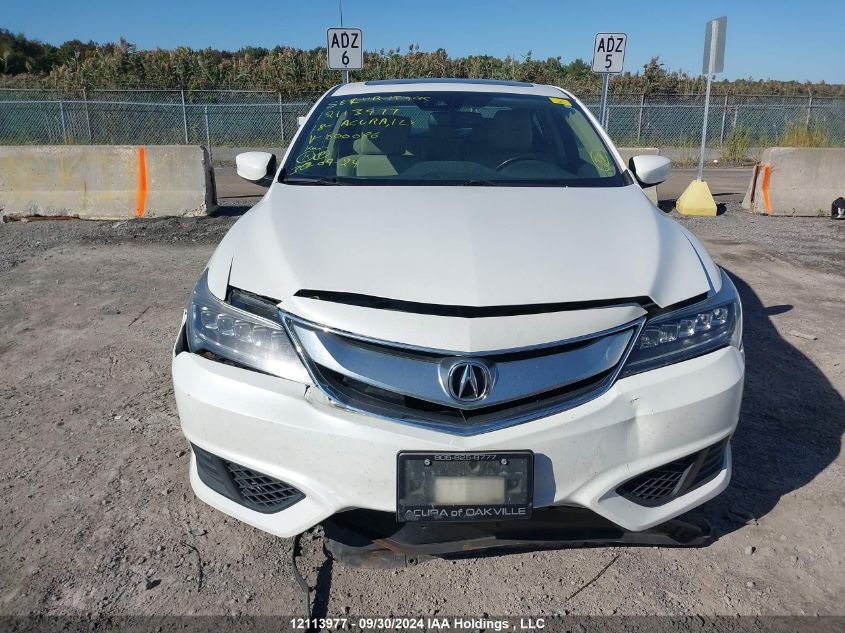 19UDE2F72JA800086 2018 Acura Ilx