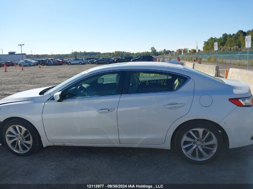 19UDE2F72JA800086 2018 Acura Ilx