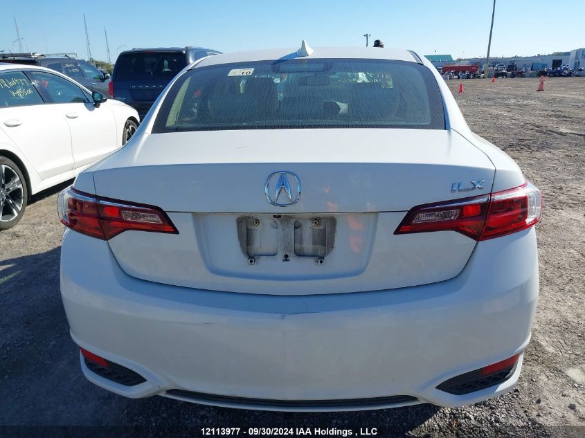 19UDE2F72JA800086 2018 Acura Ilx