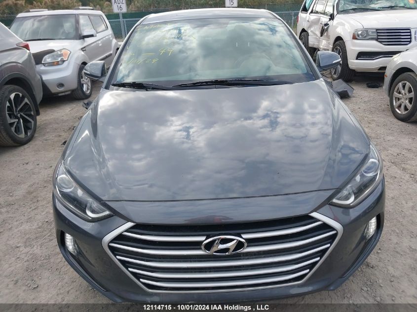 2017 Hyundai Elantra VIN: KMHD84LF3HU093632 Lot: 12114715