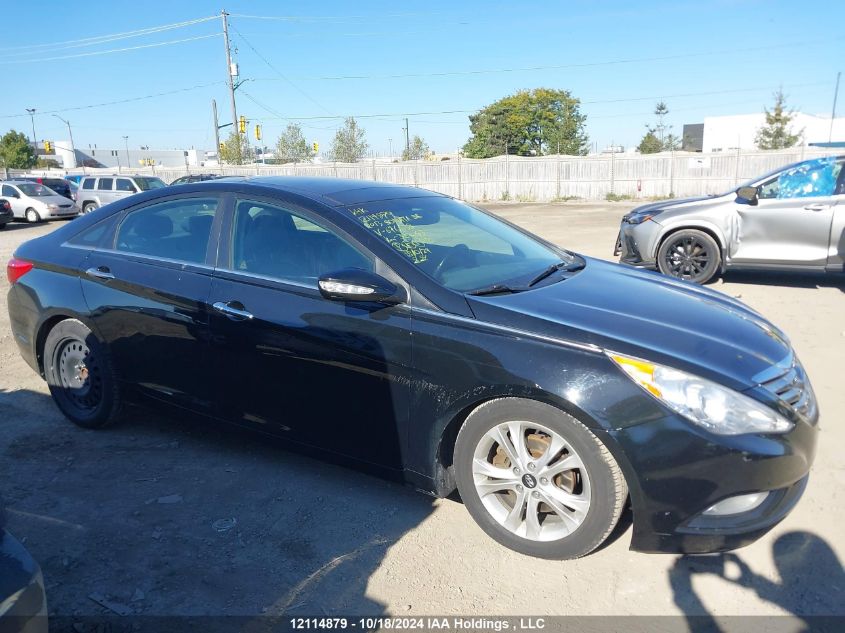 2013 Hyundai Sonata Se/Limited VIN: 5NPEC4ACXDH676638 Lot: 12114879