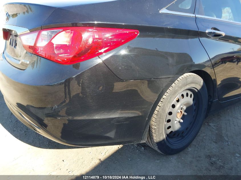 2013 Hyundai Sonata Se/Limited VIN: 5NPEC4ACXDH676638 Lot: 12114879