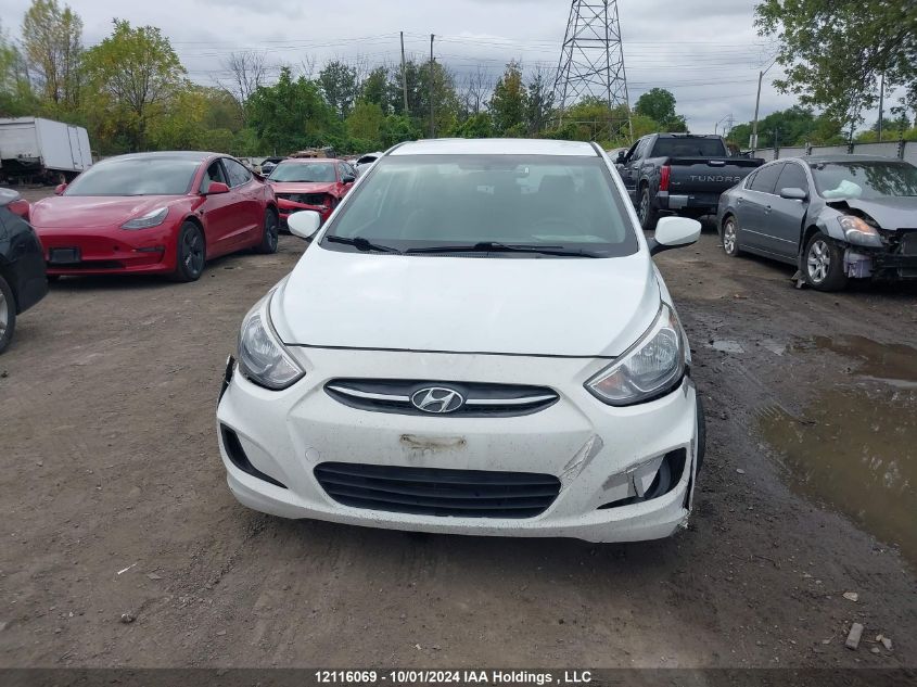 2017 Hyundai Accent Se VIN: KMHCT4AE1HU336763 Lot: 12116069