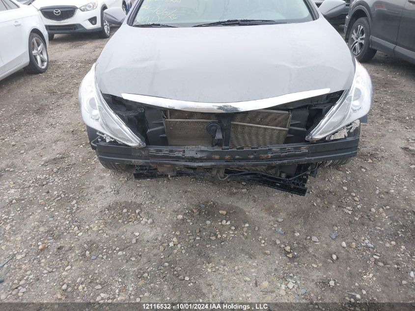 2013 Hyundai Sonata Gls VIN: 5NPEB4AC9DH771131 Lot: 12116532