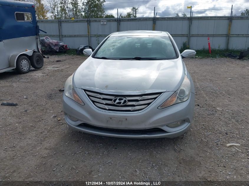 2011 Hyundai Sonata Se/Limited VIN: 5NPEC4AB6BH279013 Lot: 12120434