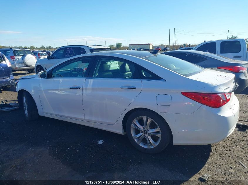 2013 Hyundai Sonata Se/Limited VIN: 5NPEC4ACXDH647611 Lot: 12120751