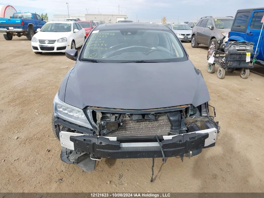 2017 Acura Ilx VIN: 19UDE2F72HA803144 Lot: 12121623