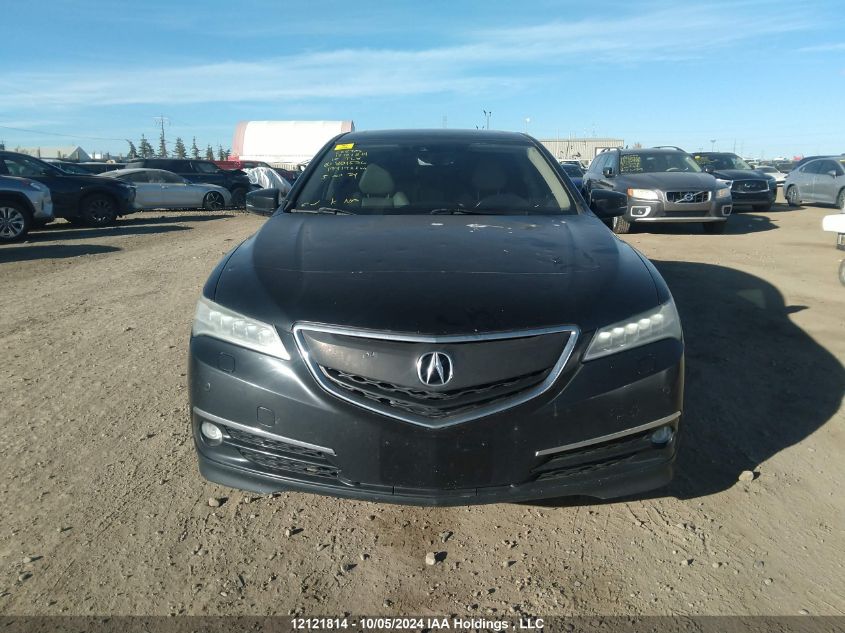 2015 Acura Tlx VIN: 19UUB3F74FA801536 Lot: 12121814