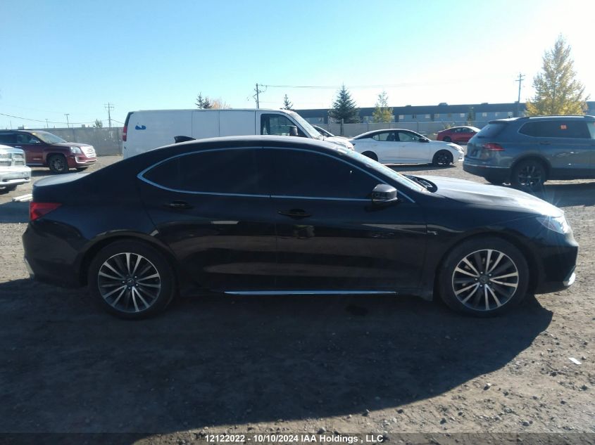 2018 Acura Tlx VIN: 19UUB3F75JA801263 Lot: 12122022