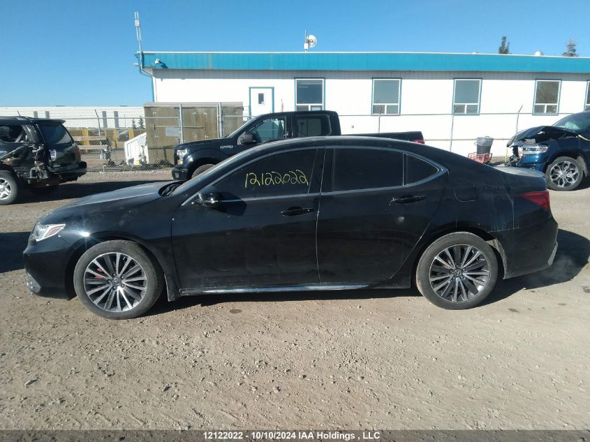 2018 Acura Tlx VIN: 19UUB3F75JA801263 Lot: 12122022