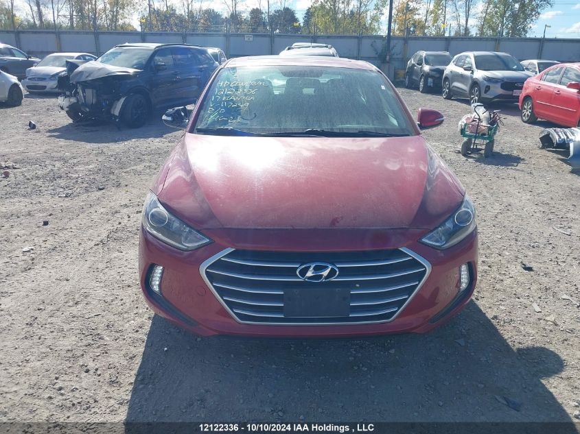 2017 Hyundai Elantra Gls VIN: KMHD84LF5HU117249 Lot: 12122336