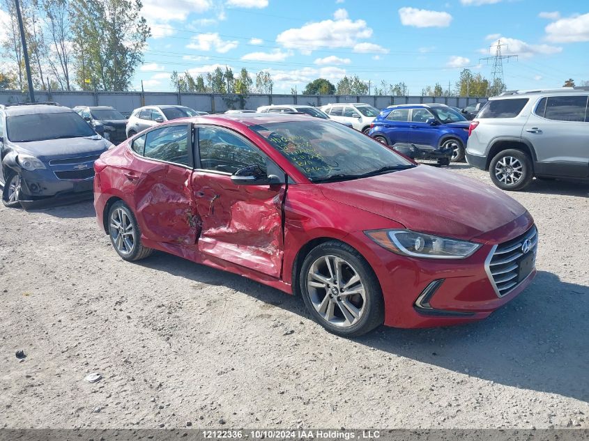 2017 Hyundai Elantra Gls VIN: KMHD84LF5HU117249 Lot: 12122336