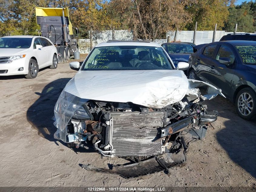 2015 Volkswagen Jetta Sedan VIN: 3VWLA7AJ0FM407197 Lot: 12122968