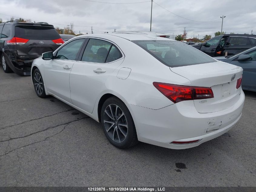 2017 Acura Tlx VIN: 19UUB3F55HA800302 Lot: 12123875