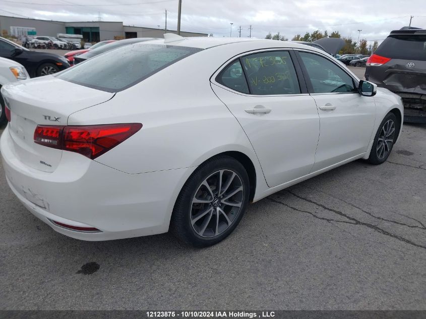 2017 Acura Tlx VIN: 19UUB3F55HA800302 Lot: 12123875