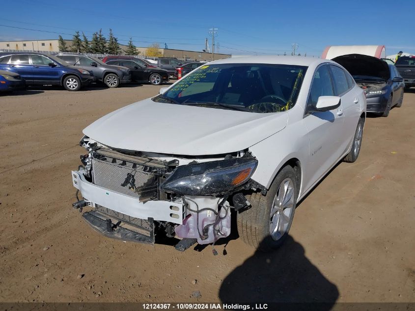 1G1ZD5ST0RF217552 2024 CHEVROLET MALIBU - Image 2