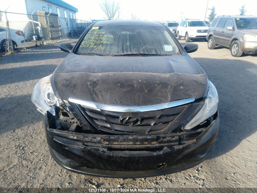 2013 Hyundai Sonata Gls VIN: 5NPEB4AC2DH728170 Lot: 12131108