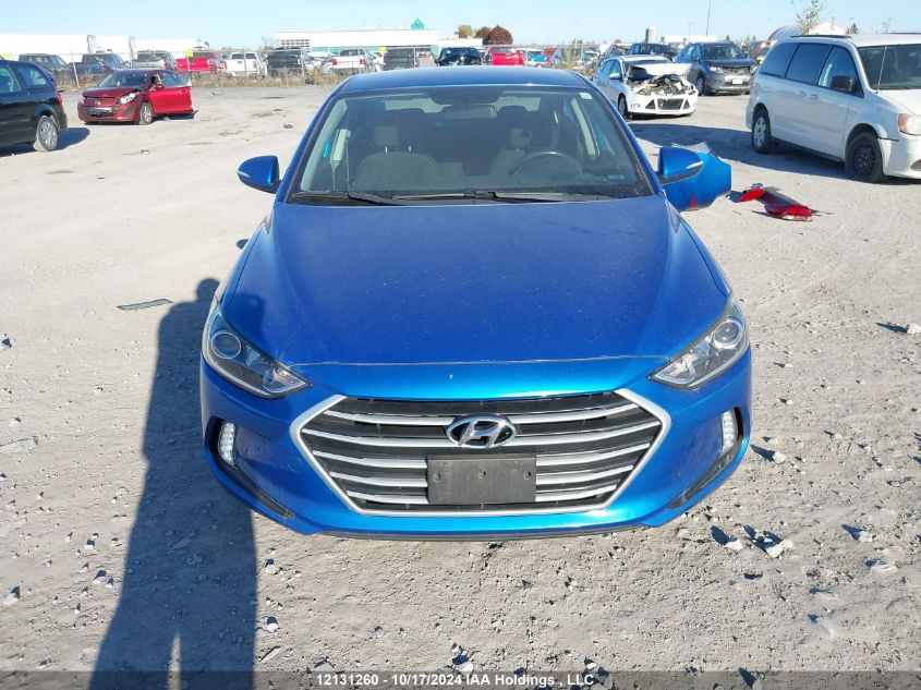 2017 Hyundai Elantra Se/Value/Limited VIN: KMHD84LF7HU135719 Lot: 12131260