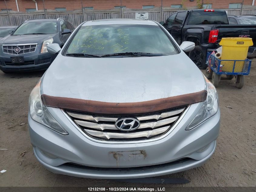 2013 Hyundai Sonata Gls VIN: 5NPEB4AC8DH693666 Lot: 12132108