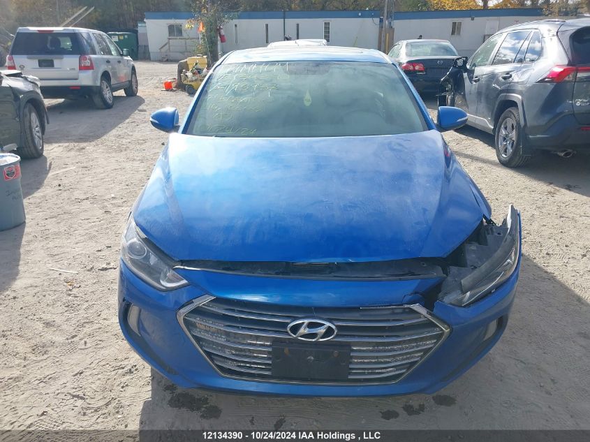 2017 Hyundai Elantra Se/Value/Limited VIN: KMHD84LFXHU193937 Lot: 12134390