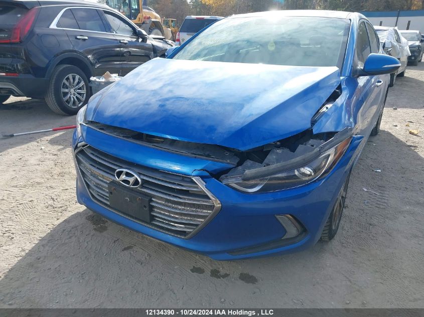 2017 Hyundai Elantra Se/Value/Limited VIN: KMHD84LFXHU193937 Lot: 12134390