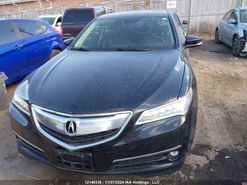 2015 Acura Tlx VIN: 19UUB3F56FA800998 Lot: 12146335