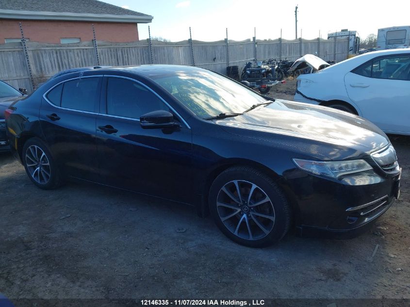 2015 Acura Tlx VIN: 19UUB3F56FA800998 Lot: 12146335